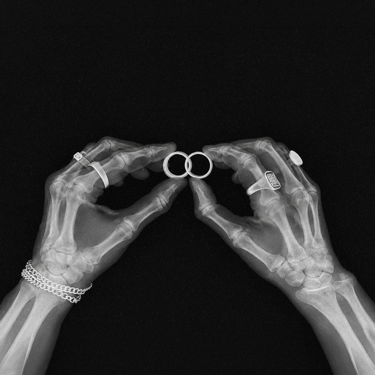 X-ray of two hands holding a smart ring and a YRH® 925 silver smart ring jacket